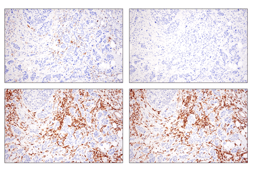 Immunohistochemistry Image 1: Phospho-SLP-76 (Ser376) (E3G9U) XP<sup>®</sup> Rabbit mAb