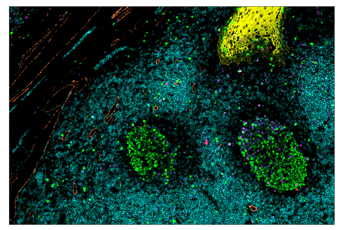 Immunohistochemistry Image 5: OX40 (E9U7O) & CO-0086-488 SignalStar<sup>™</sup> Oligo-Antibody Pair