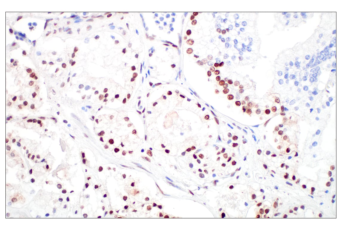 Immunohistochemistry Image 3: c-Fos (E2I7R) XP<sup>®</sup> Rabbit mAb