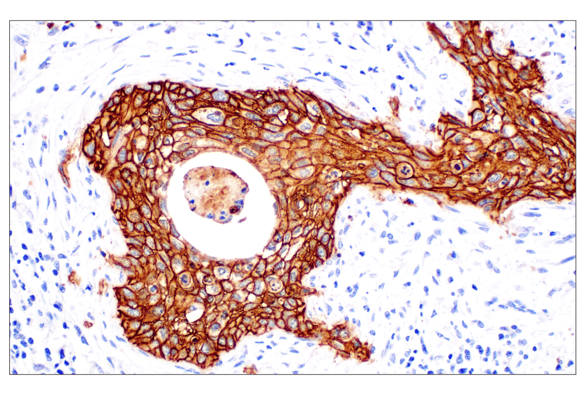 Immunohistochemistry Image 1: TACSTD2/TROP2 (F4W4J) Rabbit mAb (BSA and Azide Free)