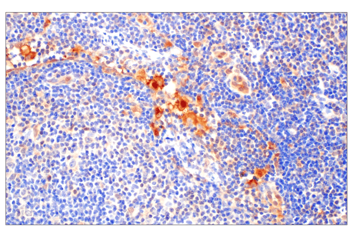 Immunohistochemistry Image 1: Galectin-8/LGALS8 (F9O3T) Rabbit mAb