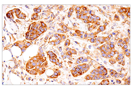 Immunohistochemistry Image 1: G3BP1 (E9G1M) XP<sup>®</sup> Rabbit mAb