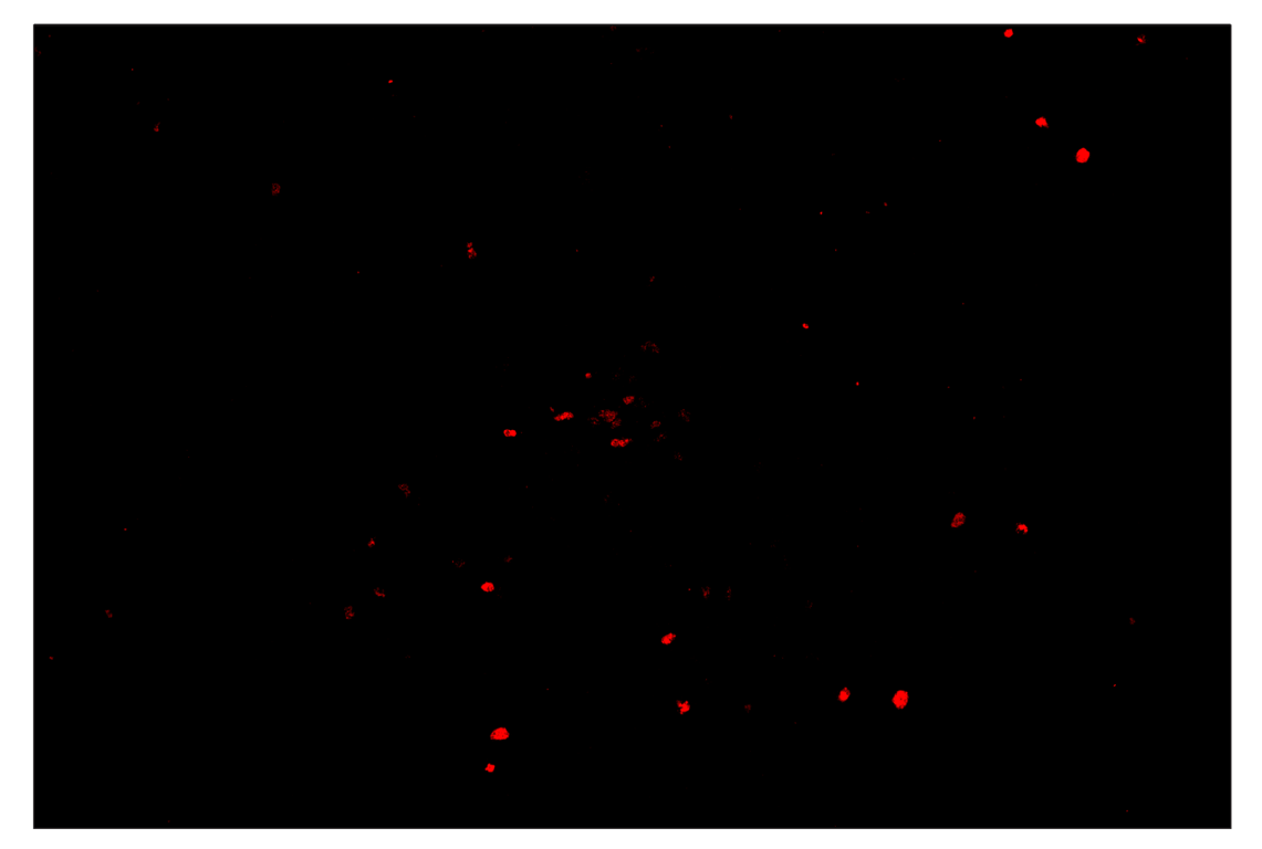 Immunohistochemistry Image 4: Phospho-Histone H2A.X (Ser139) (D7T2V) & CO-0135-647 SignalStar<sup>™</sup> Oligo-Antibody Pair