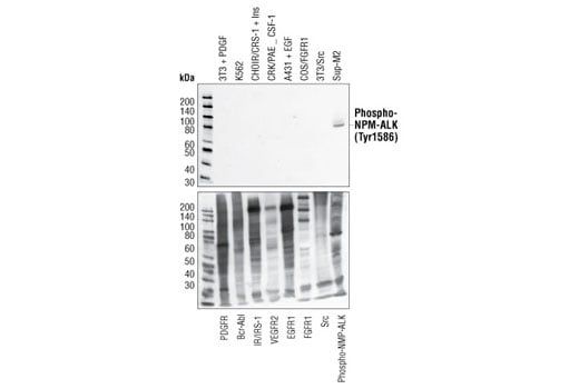 Western Blotting Image 1: Phospho-ALK (Tyr1586) Antibody