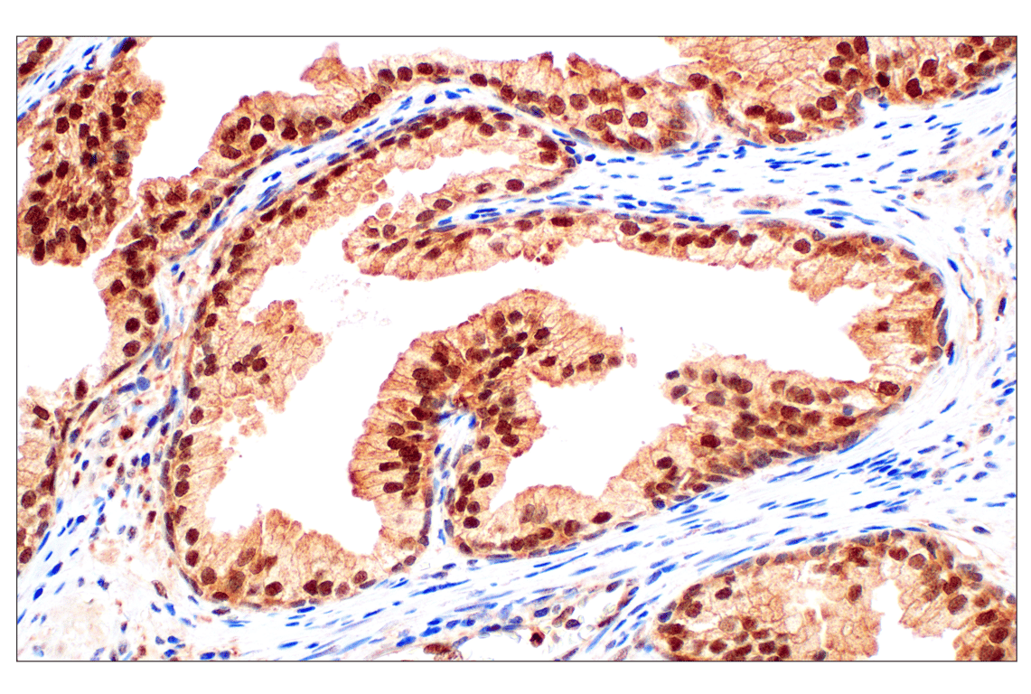 Immunohistochemistry Image 1: Stat3 (124H6) Mouse mAb