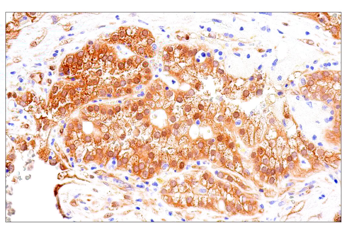 Immunohistochemistry Image 5: Phospho-YAP (Ser61) (E4Q8S) Rabbit mAb