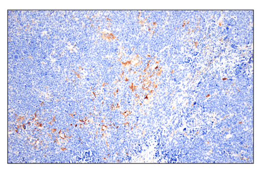 Immunohistochemistry Image 2: Phospho-SLP-76 (Ser376) (E3G9U) XP<sup>®</sup> Rabbit mAb
