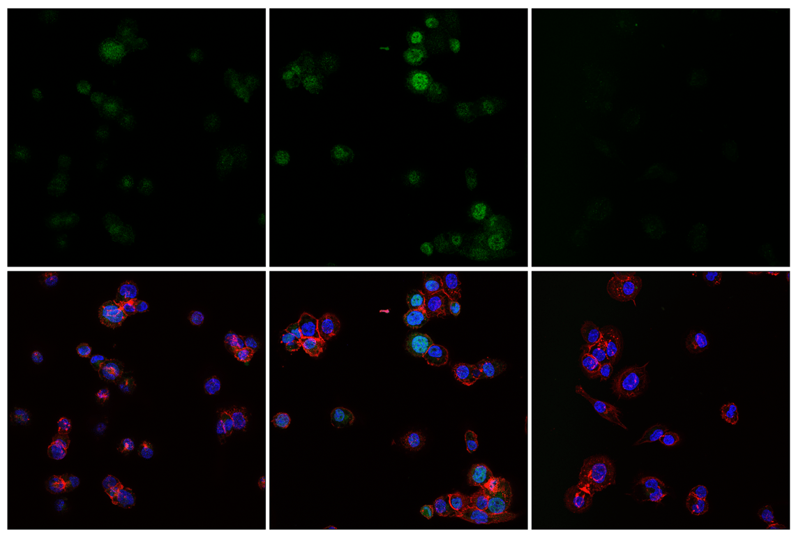 Immunofluorescence Image 1: Phospho-NF-κB p65 (Ser529) (E3K3J) Rabbit mAb