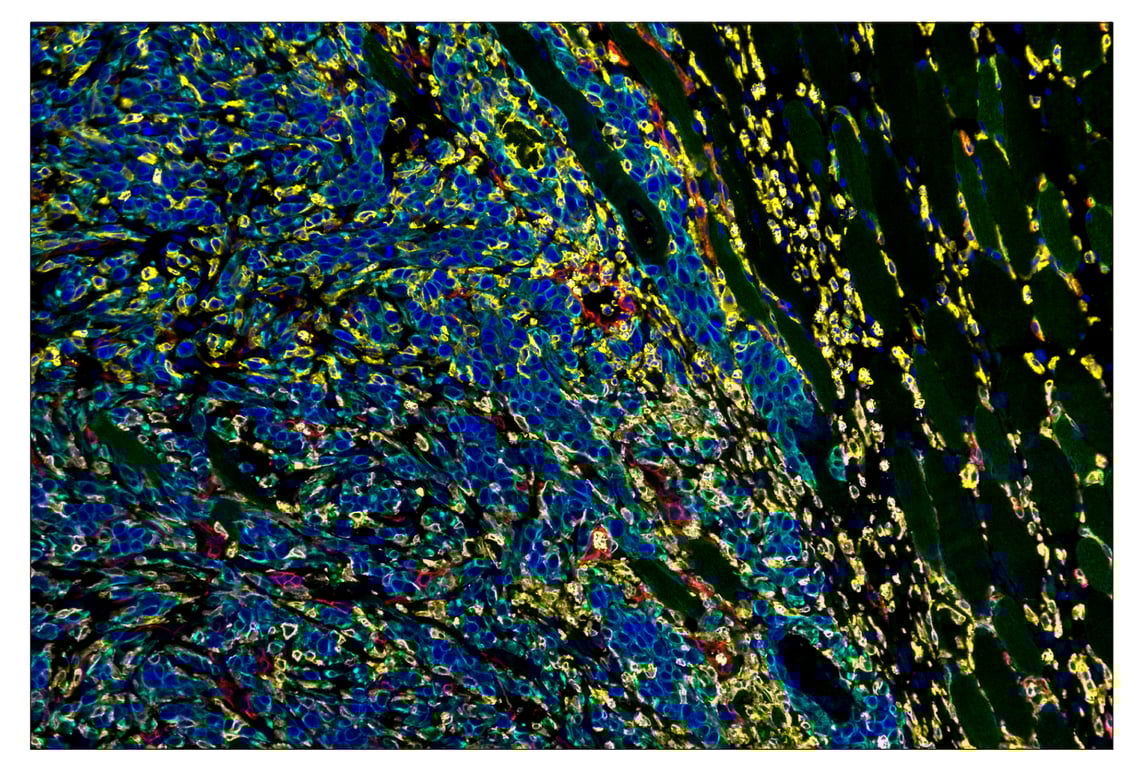 Immunohistochemistry Image 1: Pan-Keratin (Type I) (E6S1S) & CO-0072-594 SignalStar<sup>™</sup> Oligo-Antibody Pair