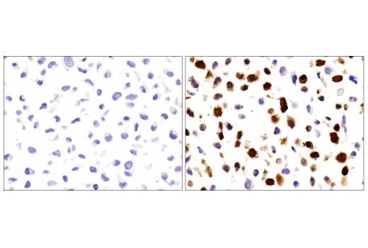 Immunohistochemistry Image 5: IDO (D5J4E<sup>™</sup>) Rabbit mAb (BSA and Azide Free)