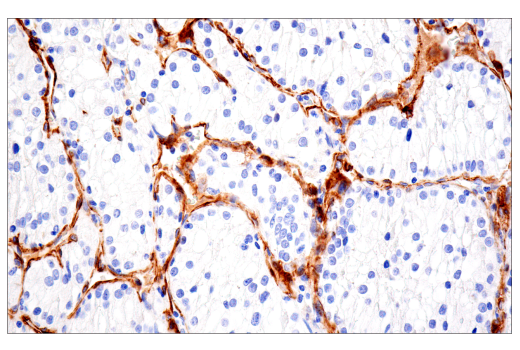 Immunohistochemistry Image 7: NG2/CSPG4 (E3B3G) XP<sup>®</sup> Rabbit mAb (BSA and Azide Free)