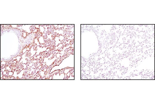 Immunohistochemistry Image 3: Caveolin-1 (D46G3) XP<sup>®</sup> Rabbit mAb