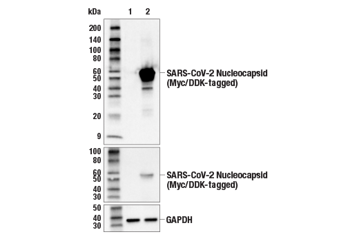 Western Blotting Image 3: SARS-CoV-2 Nucleocapsid Protein (E9L7H) XP<sup>®</sup> Rabbit mAb