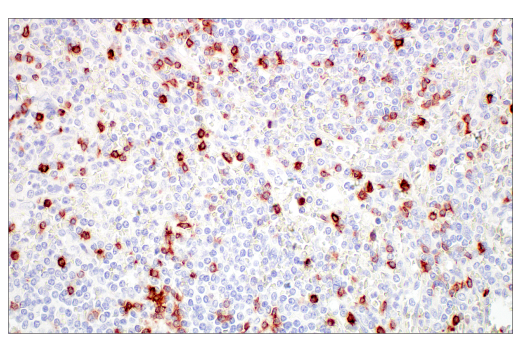 Immunohistochemistry Image 2: CD7 (E4G1Q) XP<sup>®</sup> Rabbit mAb