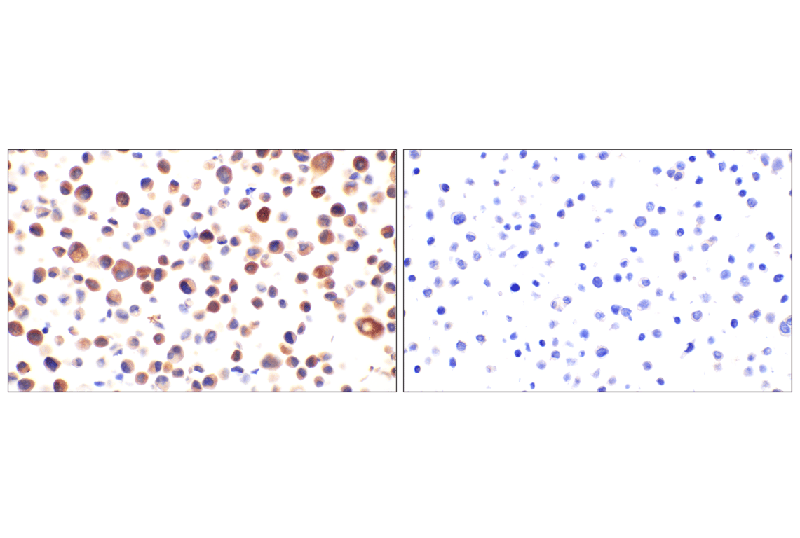 Immunohistochemistry Image 6: COL6A1 (E9U3B) Rabbit mAb (BSA and Azide Free)