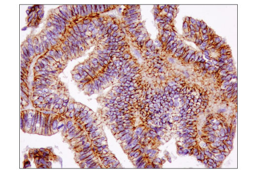 Immunohistochemistry Image 4: IQGAP1 (D8K4X) XP<sup>®</sup> Rabbit mAb