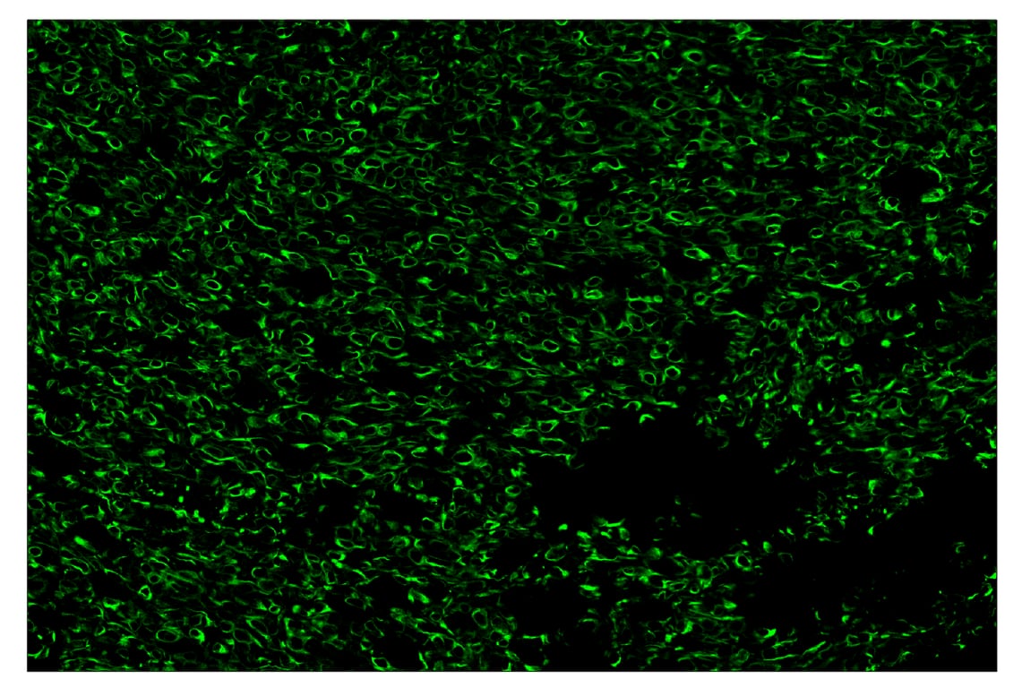 Immunohistochemistry Image 2: Pan-Keratin (Type I) (E6S1S) & CO-0072-594 SignalStar<sup>™</sup> Oligo-Antibody Pair