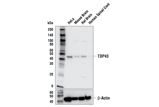 Western Blotting Image 1: TDP43 (E2G6G) Rabbit mAb