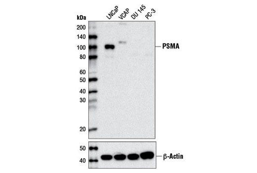 Western Blotting Image 1: Prostate Specific Membrane Antigen (D7I8E) XP<sup>®</sup> Rabbit mAb