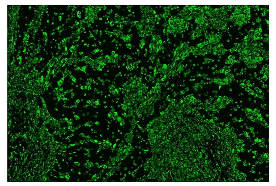 Immunohistochemistry Image 2: Vimentin (D21H3) & CO-0012-647 SignalStar<sup>™</sup> Oligo-Antibody Pair