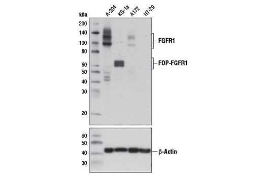 Western Blotting Image 1: FGF Receptor 1 (D8E4) XP<sup>®</sup> Rabbit mAb