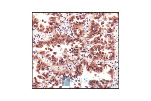 Immunohistochemistry Image 2: Phospho-Akt (Ser473) (736E11) Rabbit mAb