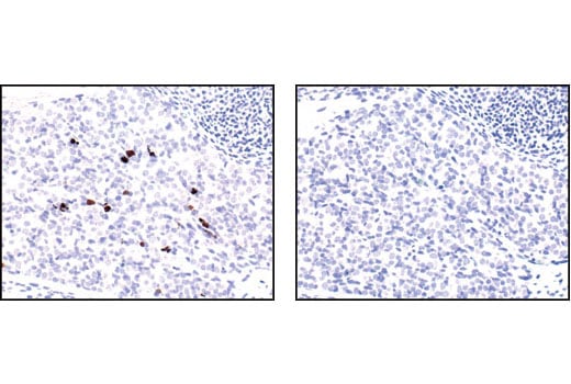 undefined Image 25: Apoptosis Antibody Sampler Kit II