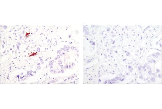 Immunohistochemistry Image 2: LC3A (D50G8) XP<sup>®</sup> Rabbit mAb