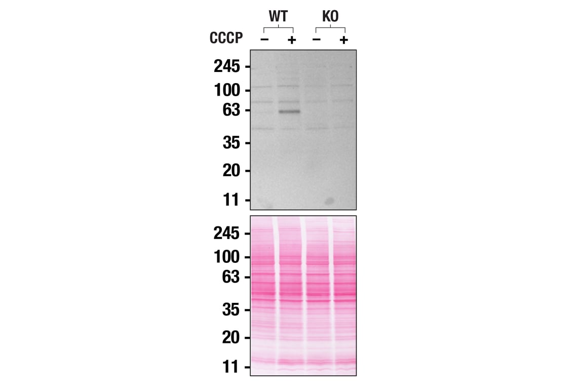 Western Blotting Image 3: PINK1 (D8G3) Rabbit mAb