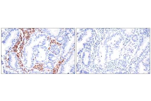 Immunohistochemistry Image 3: SLAMF6/CD352 (E3H1E) XP<sup>®</sup> Rabbit mAb (BSA and Azide Free)