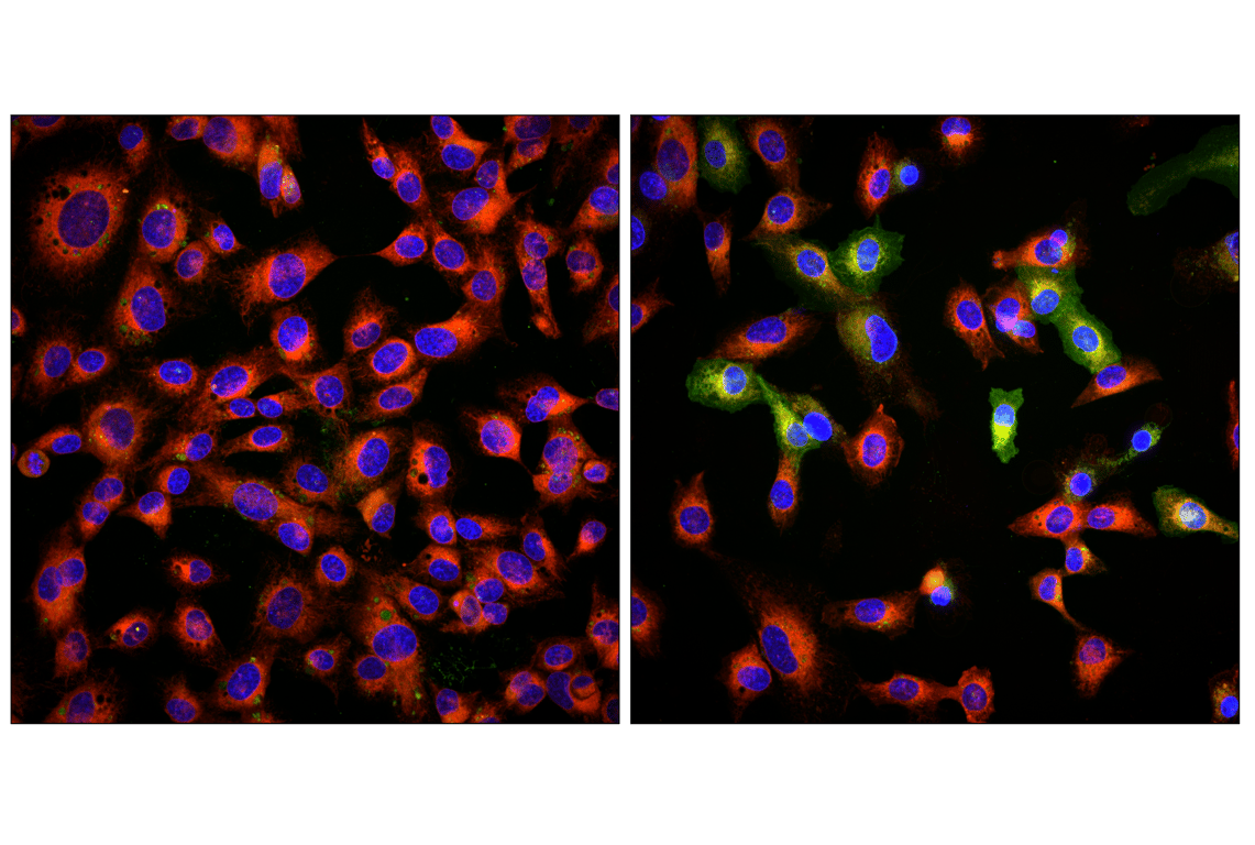 Immunofluorescence Image 2: BODIPY 581/591 C11 (Lipid Peroxidation Sensor)