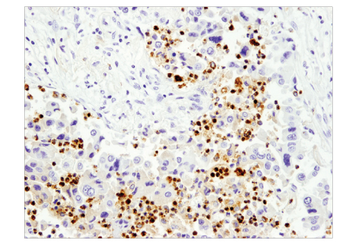 Immunohistochemistry Image 2: Myeloperoxidase (E1E7I) XP<sup>®</sup> Rabbit mAb