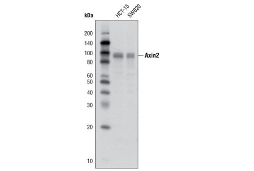 Western Blotting Image 1: Axin2 (D48G4) Rabbit mAb
