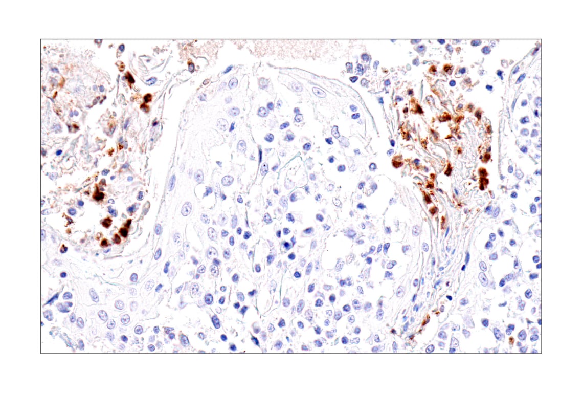 Immunohistochemistry Image 4: IL-8 (E5F5Q) XP<sup>®</sup> Rabbit mAb