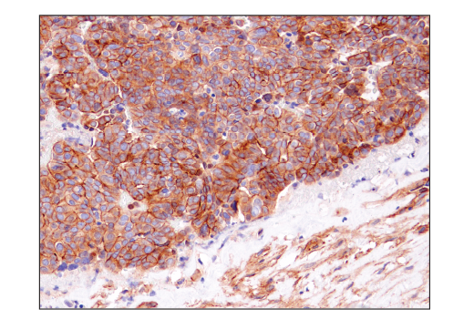 Immunohistochemistry Image 6: Notch2 (D76A6) XP<sup>®</sup> Rabbit mAb (BSA and Azide Free)