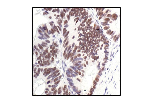 undefined Image 6: PhosphoPlus<sup>®</sup> p53 (Ser15) Antibody Duet