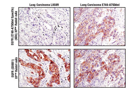 undefined Image 9: Lung Cancer RTK Antibody Sampler Kit