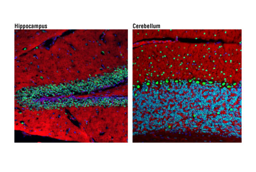 Immunofluorescence Image 1: Ezh2 (D2C9) XP<sup>®</sup> Rabbit mAb (BSA and Azide Free)