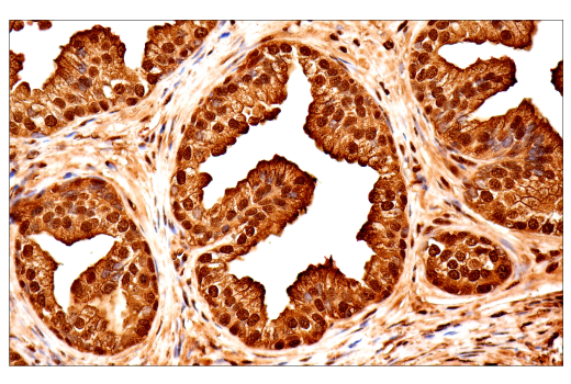 Immunohistochemistry Image 6: Ubiquitin (E6K4Y) XP<sup>®</sup> Rabbit mAb