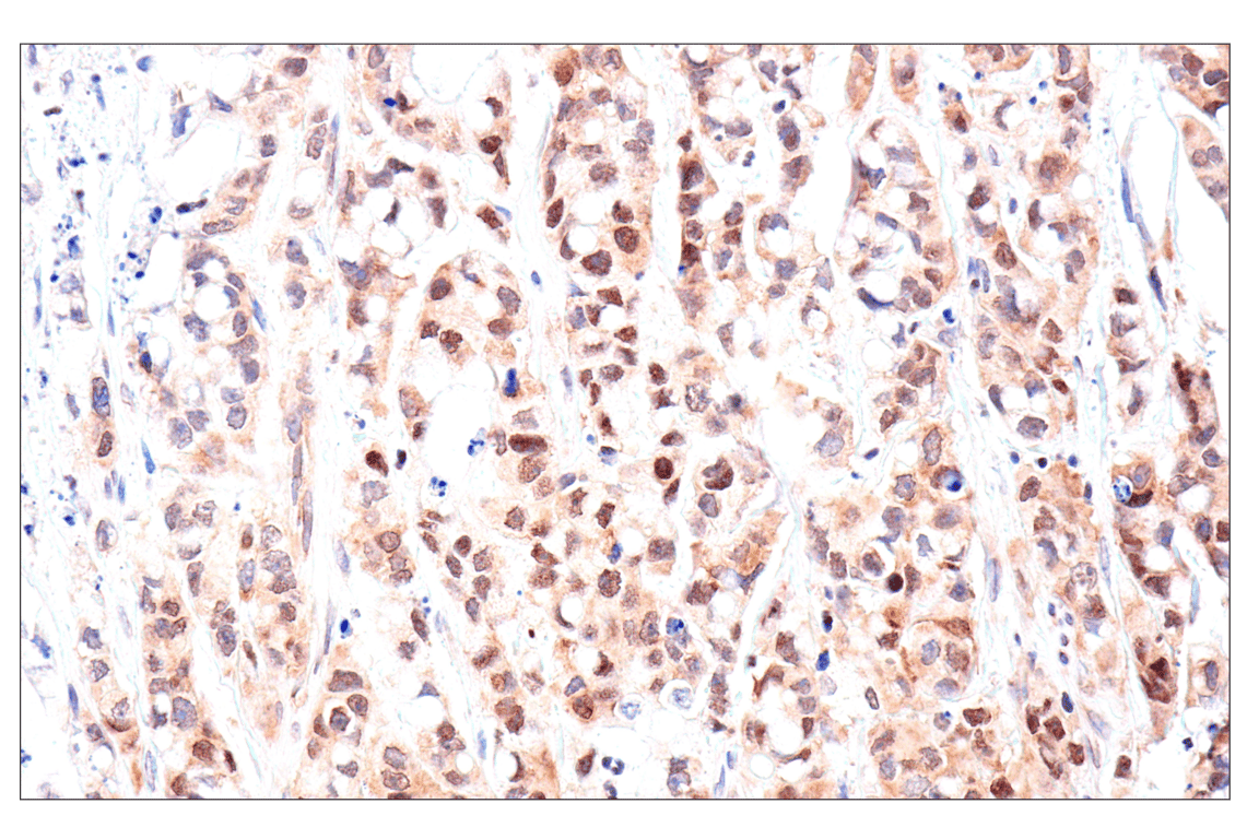 Immunohistochemistry Image 7: ADAR1 p150 Isoform   (E6U1U) Rabbit mAb   (BSA and Azide Free)