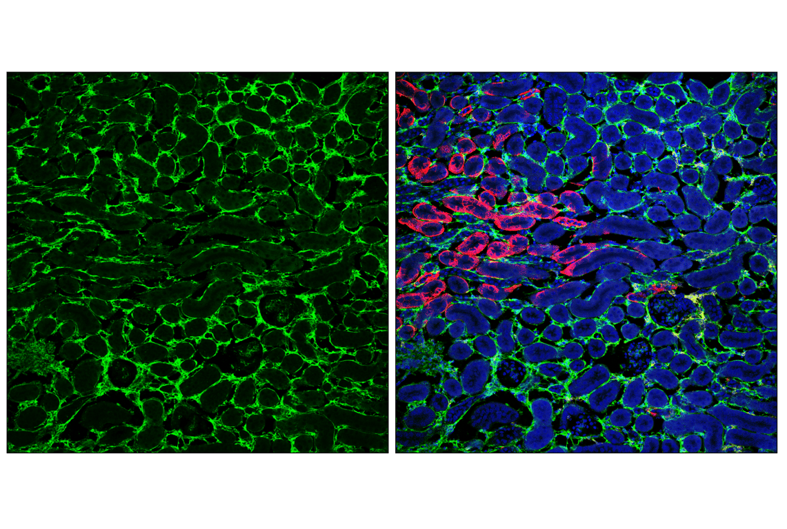 Immunofluorescence Image 3: COL6A1 (E9U3B) Rabbit mAb (BSA and Azide Free)