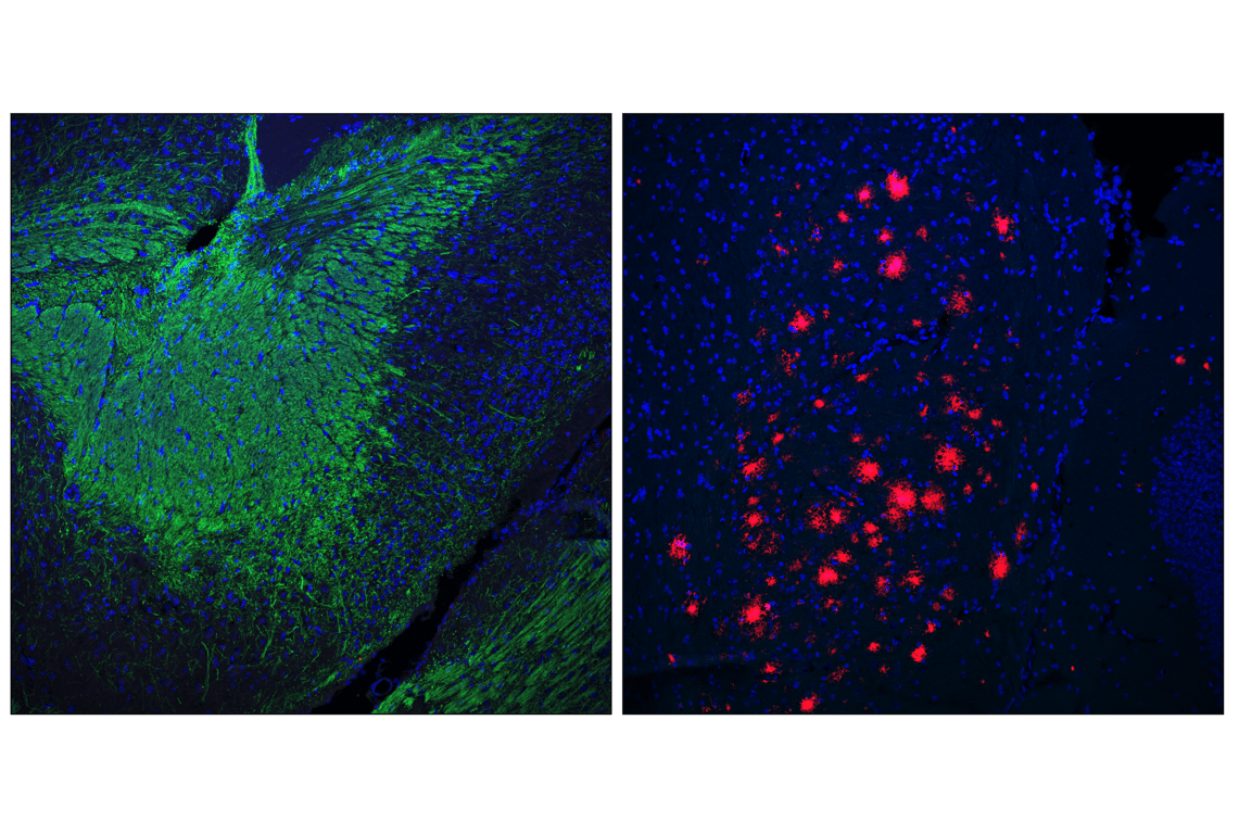 undefined Image 12: Demyelinating Disease Targets Antibody Sampler Kit