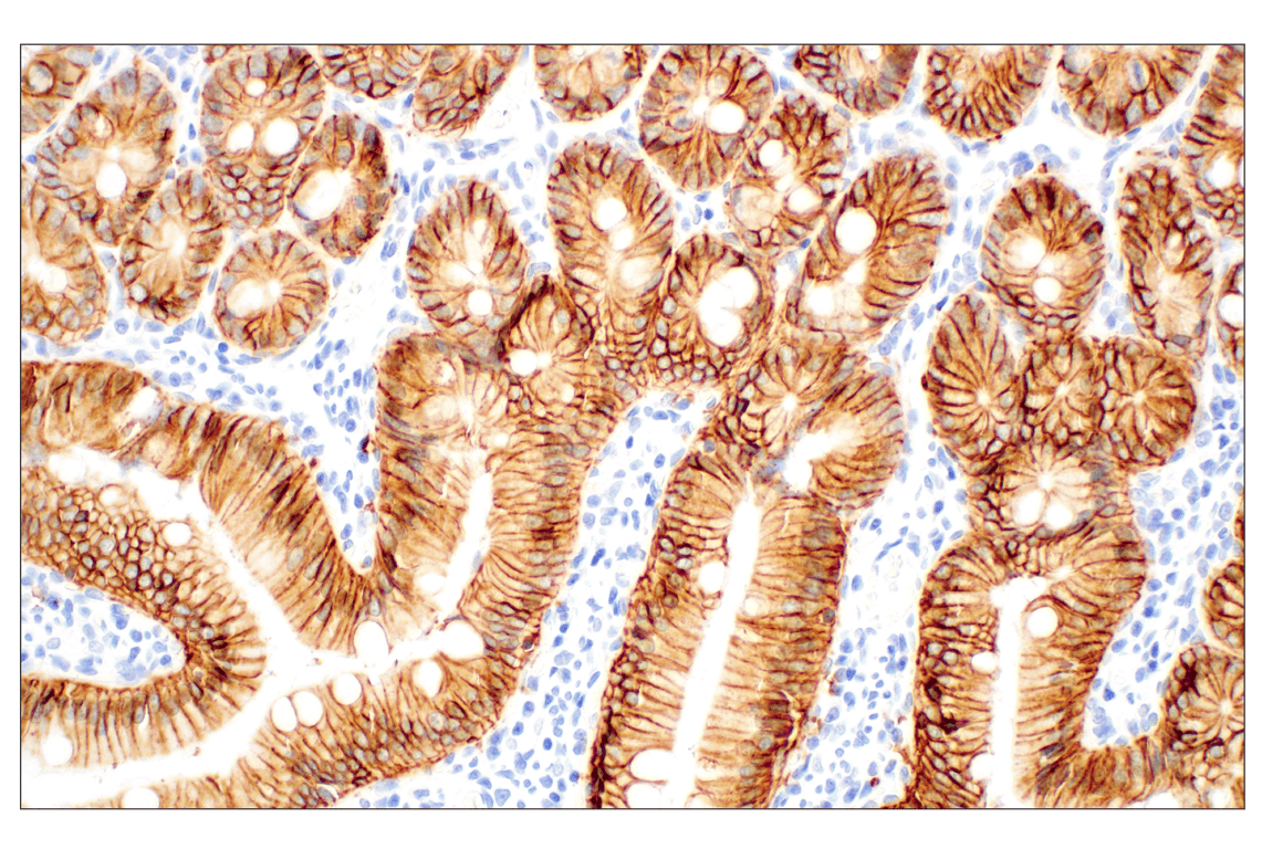 Immunohistochemistry Image 4: EpCAM (E6V8Y) XP<sup>®</sup> Rabbit mAb (BSA and Azide Free)