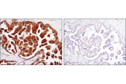 Immunohistochemistry Image 1: Phospho-EphA2 (Ser897) (D9A1) Rabbit mAb