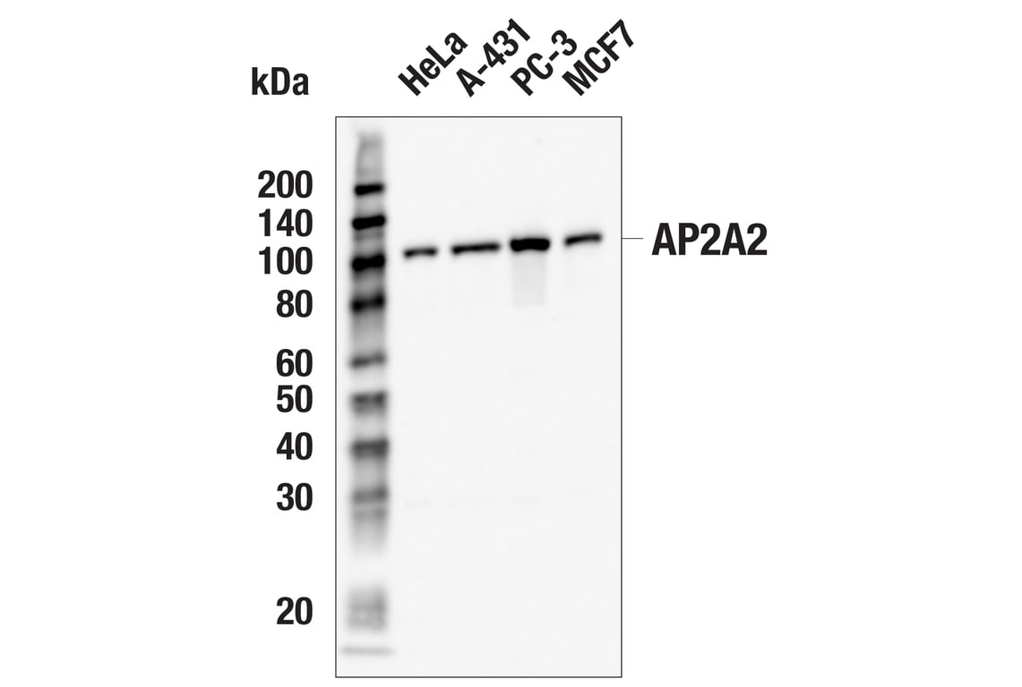 Western Blotting Image 1: AP2A2 (E9Q1O) Rabbit mAb