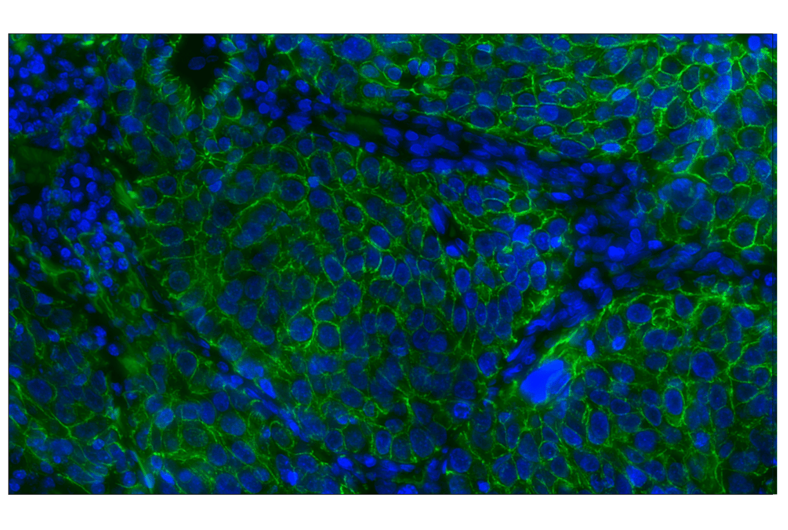 Immunohistochemistry Image 2: E-Cadherin (24E10) Rabbit mAb (Alexa Fluor<sup>®</sup> 488 Conjugate)