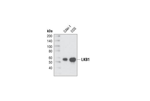 Western Blotting Image 1: LKB1 (27D10) Rabbit mAb