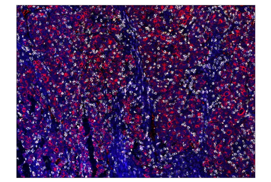 Immunohistochemistry Image 7: CD20 (E7B7T) & CO-0011-750 SignalStar<sup>™</sup> Oligo-Antibody Pair