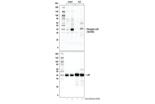 Western Blotting Image 1: Phospho-LAT (Tyr255) Antibody