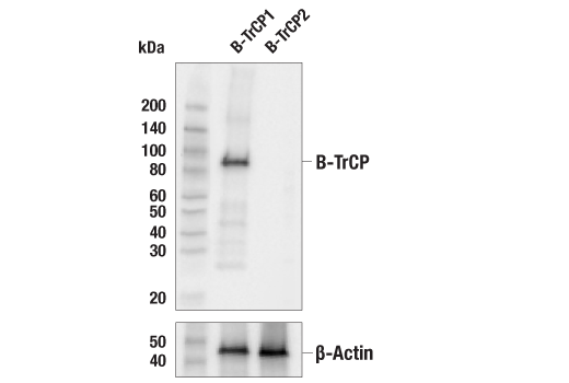 Western Blotting Image 2: β-TrCP (D12C8) Rabbit mAb